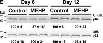 Fig.6.E showing Western Blotting from the publication: High-concentration MEHP triggers mtDNA depletion in undifferentiated HepaRG and C2C12 cultures and disrupts mitochondrial homeostasis in both HepaRG culture states.