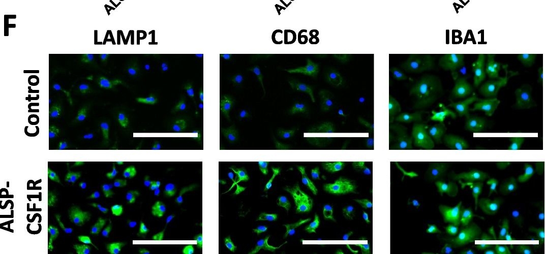 Fig.6.F showing Immunocytochemistry-immunofluorescence from the publication: An adapted protocol to derive microglia from stem cells and its application in the study of CSF1R-related disorders.