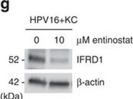 Fig.4.G showing Western Blotting from the publication: The interferon-related developmental regulator 1 is used by human papillomavirus to suppress NFκB activation.