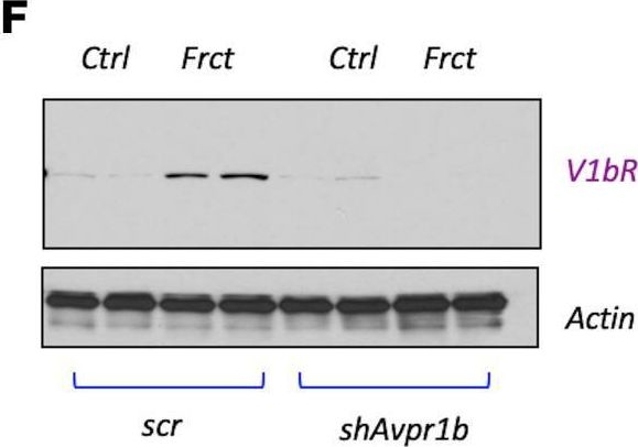 Fig.6.F showing Western Blotting in a Homo sapiens (Human) sample from the publication: Vasopressin mediates fructose-induced metabolic syndrome by activating the V1b receptor.