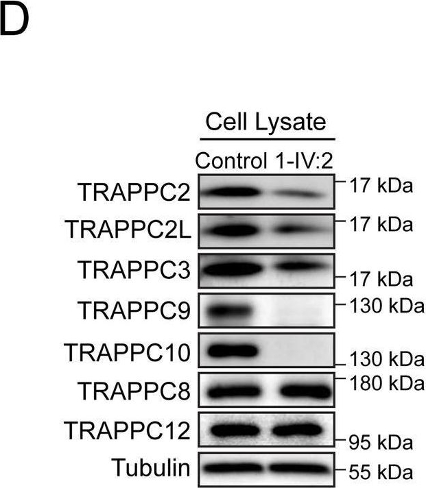 Fig.2.D showing Western Blotting from the publication: Biallelic variants in TRAPPC10 cause a microcephalic TRAPPopathy disorder in humans and mice.