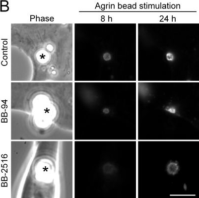 Fig.7.B showing Immunocytochemistry-immunofluorescence from the publication: Site-directed MT1-MMP trafficking and surface insertion regulate AChR clustering and remodeling at developing NMJs.