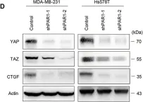 Fig.4.D showing Western Blotting from the publication: Twist-mediated PAR1 induction is required for breast cancer progression and metastasis by inhibiting Hippo pathway.