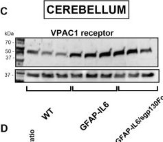 Fig.5.C showing Western Blotting in a Mus musculus (House mouse) sample from the publication: Increased Expression of the Neuropeptides PACAP/VIP in the Brain of Mice with CNS Targeted Production of IL-6 Is Mediated in Part by Trans-Signalling.