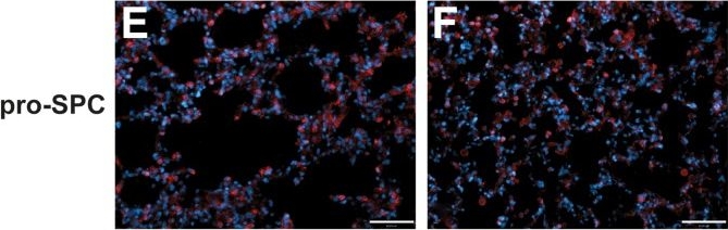Fig.3.E,F showing Immunohistochemistry-immunofluorescence in a Homo sapiens (Human) sample from the publication: Biomimetic Culture Reactor for Whole-Lung Engineering.