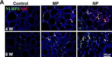 Fig.4.A showing Immunohistochemistry-immunofluorescence in a Mus musculus (House mouse) sample from the publication: Micro/nanoplastics induce thyroid follicular cell pyroptosis to trigger thyrotoxicity by activating NF-κB signaling.