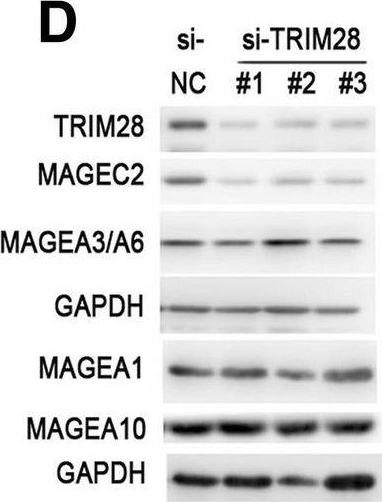 Fig.2.D showing Western Blotting in a Homo sapiens (Human) sample from the publication: Post-transcriptional regulation of cancer/testis antigen MAGEC2 expression by TRIM28 in tumor cells.