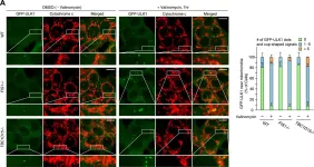 Fig.2.A showing Immunocytochemistry-immunofluorescence from the publication: Mitochondrial Rab GAPs govern autophagosome biogenesis during mitophagy.
