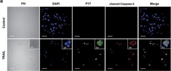Cleaved Caspase-3 (Asp175) (D3E9) Rabbit Monoclonal Antibody