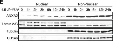 Fig.1.E showing Western Blotting in a Homo sapiens (Human) sample from the publication: Genotoxic agents promote the nuclear accumulation of annexin A2: role of annexin A2 in mitigating DNA damage.