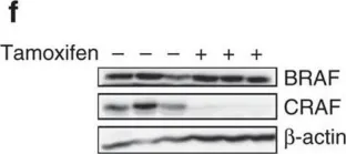 Fig.3.F showing Western Blotting from the publication: RAF proteins exert both specific and compensatory functions during tumour progression of NRAS-driven melanoma.