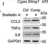 Fig.2.J showing Western Blotting from the publication: Mechanical Force-Induced cGAS Activation in Carcinoma Cells Facilitates Splenocytes into Liver to Drive Metastasis.
