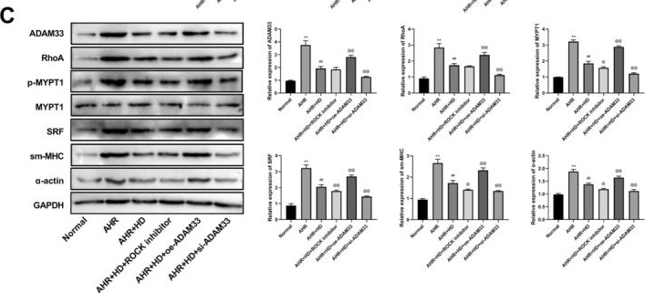 Fig.2.C showing Western Blotting from the publication: Tongjiang Hewei Decoction Improves Airway Hyperresponsiveness in Gastroesophageal Reflux Cough by Inhibiting ADAM33 and Epac1/Rap1 Pathway.