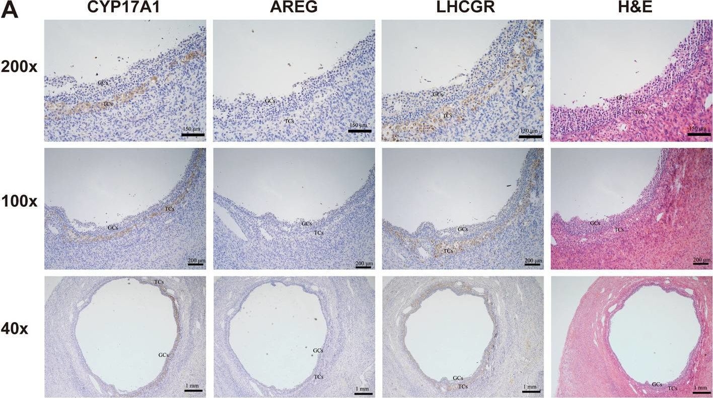 Fig.2.A showing Immunohistochemistry from the publication: Luteinizing hormone stimulates the expression of amphiregulin in human theca cells.