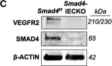 Fig.6.C showing Western Blotting in a Mus musculus (House mouse) sample from the publication: Vascular deficiency of Smad4 causes arteriovenous malformations: a mouse model of Hereditary Hemorrhagic Telangiectasia.