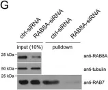 Fig.5.G showing Western Blotting in a Homo sapiens (Human) sample from the publication: The G2019S variant of leucine-rich repeat kinase 2 (LRRK2) alters endolysosomal trafficking by impairing the function of the GTPase RAB8A.