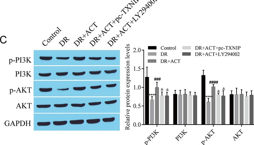 Fig.8.C showing Western Blotting in a Rattus norvegicus (Rat) sample from the publication: Acteoside relieves diabetic retinopathy through the inhibition of Müller cell reactive hyperplasia by regulating TXNIP and mediating Kir4.1 channels in a PI3K/Akt-dependent manner.