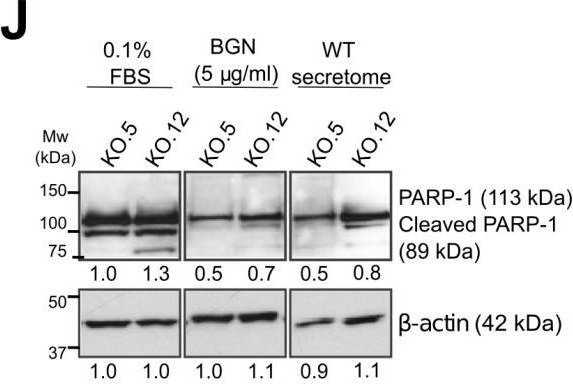 Fig.5.J showing Western Blotting from the publication: The Extracellular Small Leucine-Rich Proteoglycan Biglycan Is a Key Player in Gastric Cancer Aggressiveness.