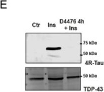 Fig.3.E showing Western Blotting from the publication: 4R-tau isoform induction via TDP-43 in neurons in response to insulin: converging signaling pathways with implications for neurodegenerative disease.