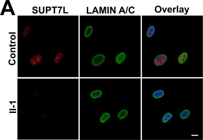 Fig.3.A showing Immunocytochemistry-immunofluorescence from the publication: Loss-of-function variants affecting the STAGA complex component SUPT7L cause a developmental disorder with generalized lipodystrophy.