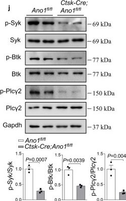 Fig.5.J showing Western Blotting from the publication: Anoctamin 1 controls bone resorption by coupling Cl- channel activation with RANKL-RANK signaling transduction.