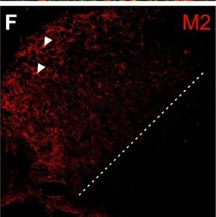 Fig.6.F showing Immunohistochemistry-immunofluorescence in a Meriones unguiculatus (Mongolian gerbil) sample from the publication: Muscarinic modulation of M and h currents in gerbil spherical bushy cells.