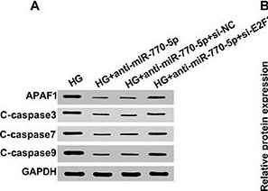 Fig.6.A showing Western Blotting from the publication: MicroRNA-770-5p contributes to podocyte injury via targeting E2F3 in diabetic nephropathy.