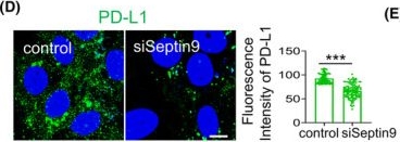 Fig.7.D showing Immunocytochemistry-immunofluorescence from the publication: Septin 9 expression regulates 'don't eat me' signals and identifies an immune-epithelial class of intrahepatic cholangiocarcinoma.