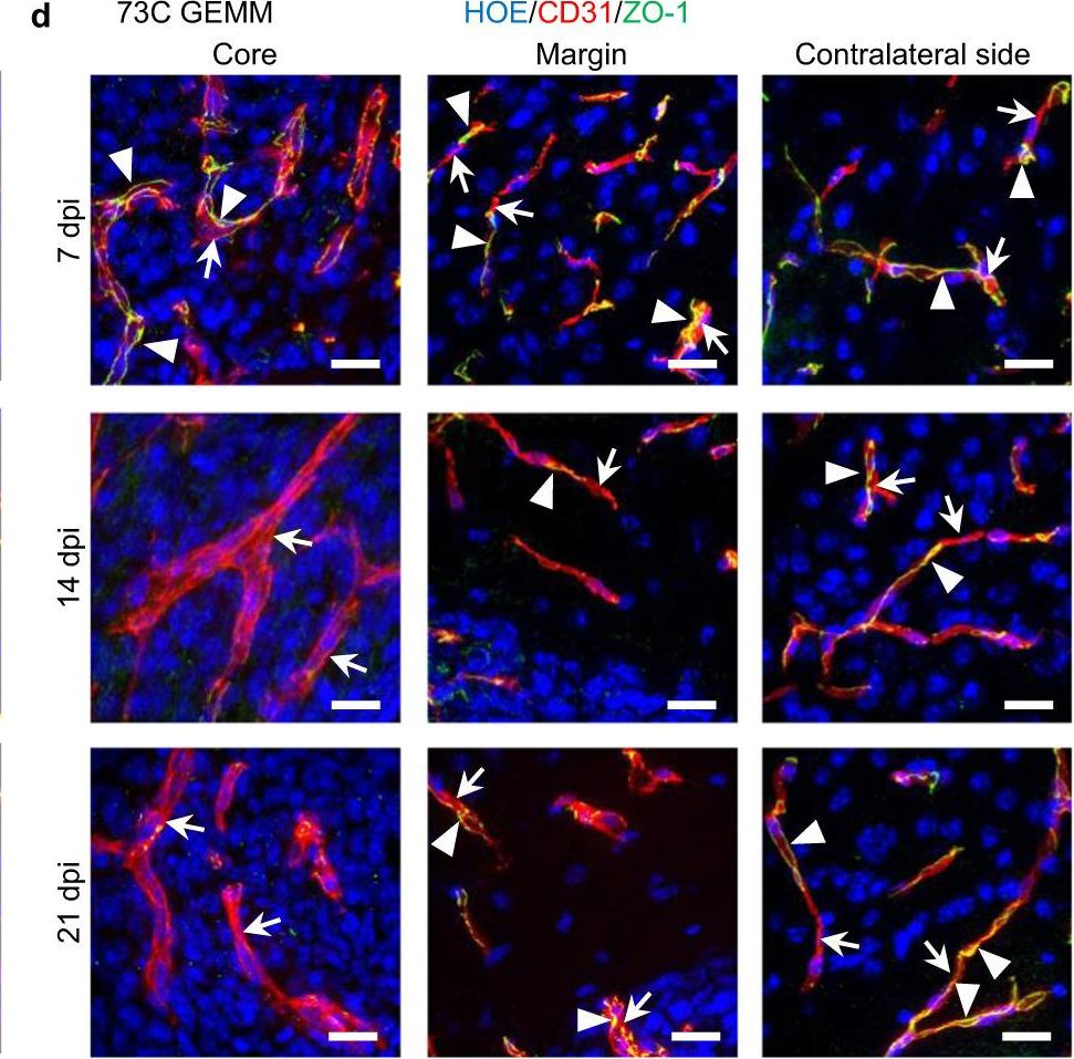 Fig.2.D showing Immunohistochemistry in a Mus musculus (House mouse) sample from the publication: Optical blood-brain-tumor barrier modulation expands therapeutic options for glioblastoma treatment.