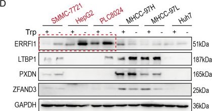 Fig.2.D showing Western Blotting from the publication: ERRFI1 induces apoptosis of hepatocellular carcinoma cells in response to tryptophan deficiency.