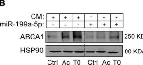 Fig.6.B showing Western Blotting from the publication: Role of miR-199a-5p in the post-transcriptional regulation of ABCA1 in response to hypoxia in peritoneal macrophages.