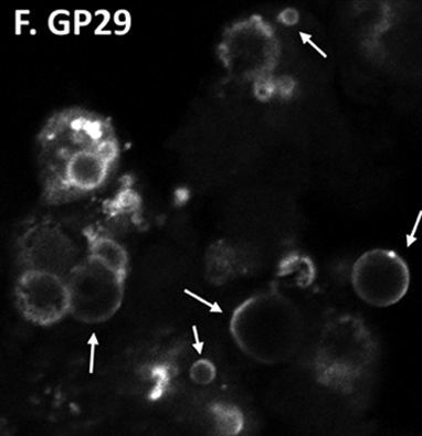 Differential phosphorylation of perilipin 1A at the initiation of lipolysis revealed by novel monoclonal antibodies and high content analysis.