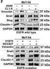 Fig.2.F showing Western Blotting in a Homo sapiens (Human) sample from the publication: Characterization of the pleural microenvironment niche and cancer transition using single-cell RNA sequencing in EGFR-mutated lung cancer.