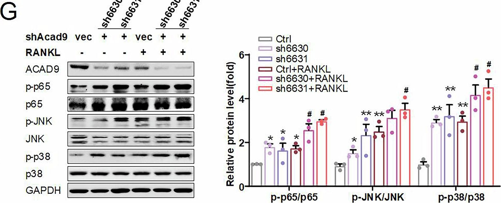 Fig.4.G showing Western Blotting from the publication: Moonlighting cytosolic function of ACAD9: suppression of TRAF6-mediated osteoclastogenesis and protection against osteoporosis.