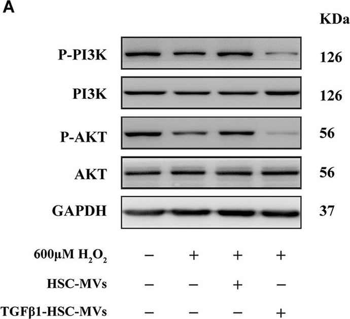 Fig.4.A showing Western Blotting in a Homo sapiens (Human) sample from the publication: Microvesicles from quiescent and TGF-β1 stimulated hepatic stellate cells: Divergent impact on hepatic vascular injury.