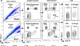 Fig.3.B showing Flow cytometry/Cell sorting in a Mus musculus (House mouse) sample from the publication: A Shift in Myeloid Cell Phenotype via Down Regulation of Siglec-1 in Island Macrophages of Bone Marrow Is Associated With Decreased Late Erythroblasts Seen in Anemia of Critical Illness.