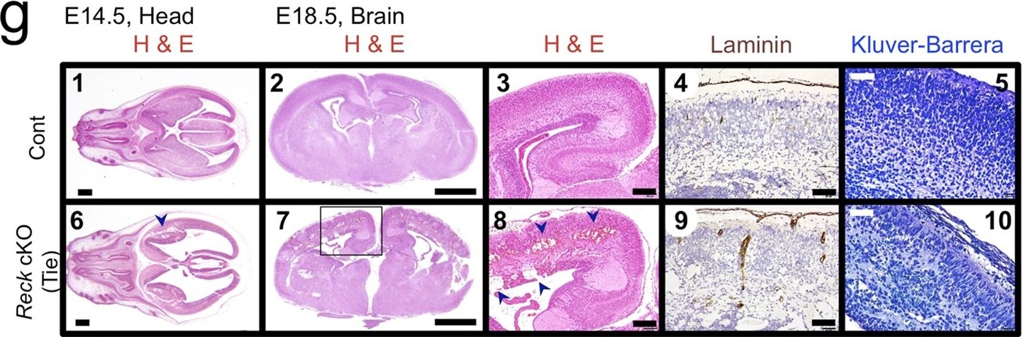 Critical roles for murine Reck in the regulation of vascular patterning and stabilization.