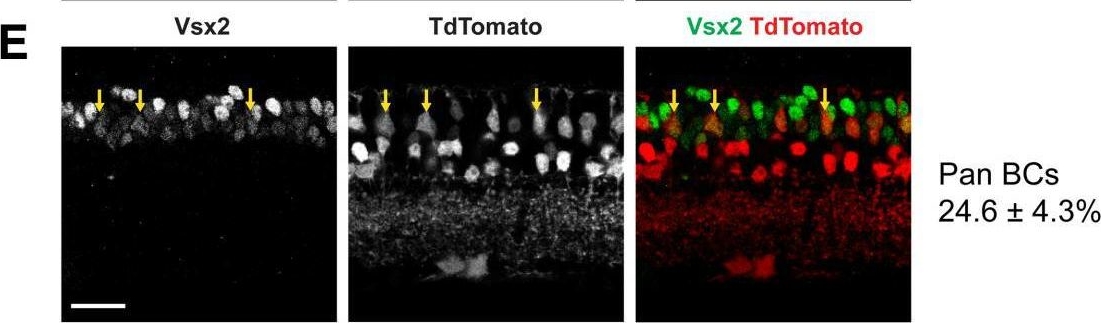 Fig.2.E showing Immunohistochemistry-immunofluorescence in a Mus musculus (House mouse) sample from the publication: The Atoh1-Cre Knock-In Allele Ectopically Labels a Subpopulation of Amacrine Cells and Bipolar Cells in Mouse Retina.