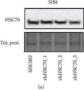 Fig.2.A showing Western Blotting in a Homo sapiens (Human) sample from the publication: Chaperone-Mediated Autophagy Markers LAMP2A and HSC70 Are Independent Adverse Prognostic Markers in Primary Resected Squamous Cell Carcinomas of the Lung.
