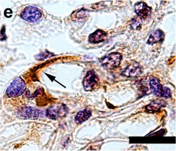 Fig.6.E showing Immunohistochemistry in a Homo sapiens (Human) sample from the publication: Prevalence of neural epidermal growth factor-like 1- and exostosin 1/exostosin 2-associated membranous nephropathy: a single-center retrospective study in Japan.