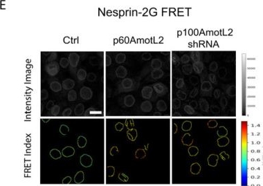 Fig.7.E showing Immunocytochemistry-immunofluorescence from the publication: Modulation of E-Cadherin Function through the AmotL2 Isoforms Promotes Ameboid Cell Invasion.