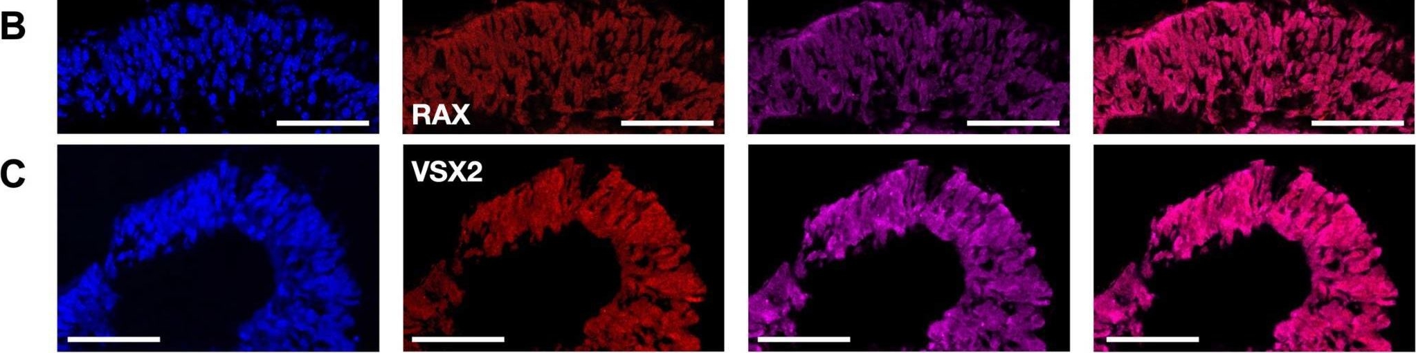 Fig.4.B showing Immunohistochemistry-immunofluorescence from the publication: Generation of a Double Reporter mES Cell Line to Simultaneously Trace the Generation of Retinal Progenitors and Photoreceptors.