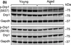 Fig.6.B showing Western Blotting from the publication: Aging is associated with a decline in Atg9b-mediated autophagosome formation and appearance of enlarged mitochondria in the heart.