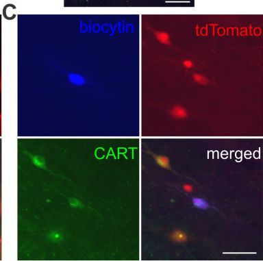 Fig.5.C showing Immunocytochemistry-immunofluorescence in a Mus musculus (House mouse) sample from the publication: Electrophysiological properties of melanin-concentrating hormone neuron subpopulations defined by anatomical localization and CART expression.