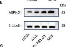 Fig.1.E showing Western Blotting in a Homo sapiens (Human) sample from the publication: Aspartate beta-hydroxylase domain containing 1 as a prognostic marker associated with immune infiltration in skin cutaneous melanoma.