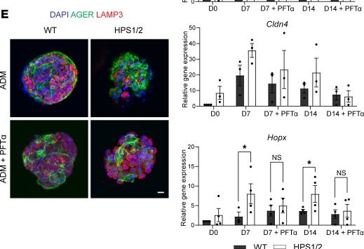 Fig.6.E showing Immunocytochemistry-immunofluorescence in a Mus musculus (House mouse) sample from the publication: Dysregulated alveolar epithelial cell progenitor function and identity in Hermansky-Pudlak syndrome.