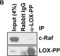 Fig.9.B showing Western Blotting in a Homo sapiens (Human) sample from the publication: Blimp1 activation by AP-1 in human lung cancer cells promotes a migratory phenotype and is inhibited by the lysyl oxidase propeptide.