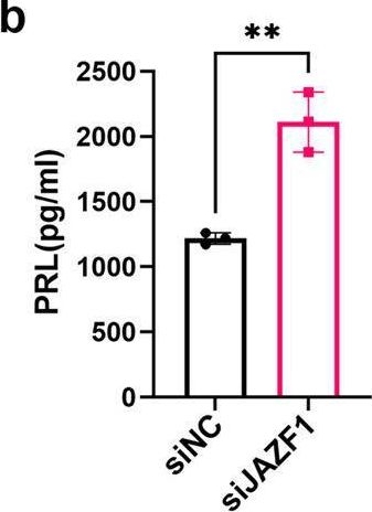 Fig.3.B showing Enzyme-linked immunosorbent assay from the publication: JAZF1 safeguards human endometrial stromal cells survival and decidualization by repressing the transcription of G0S2.