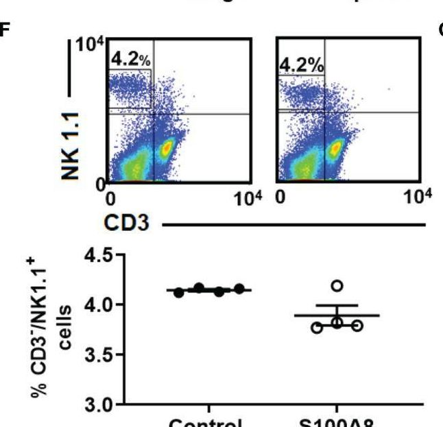 Fig.6.F showing Flow cytometry/Cell sorting from the publication: Intranasal Delivery of Recombinant S100A8 Protein Delays Lung Cancer Growth by Remodeling the Lung Immune Microenvironment.