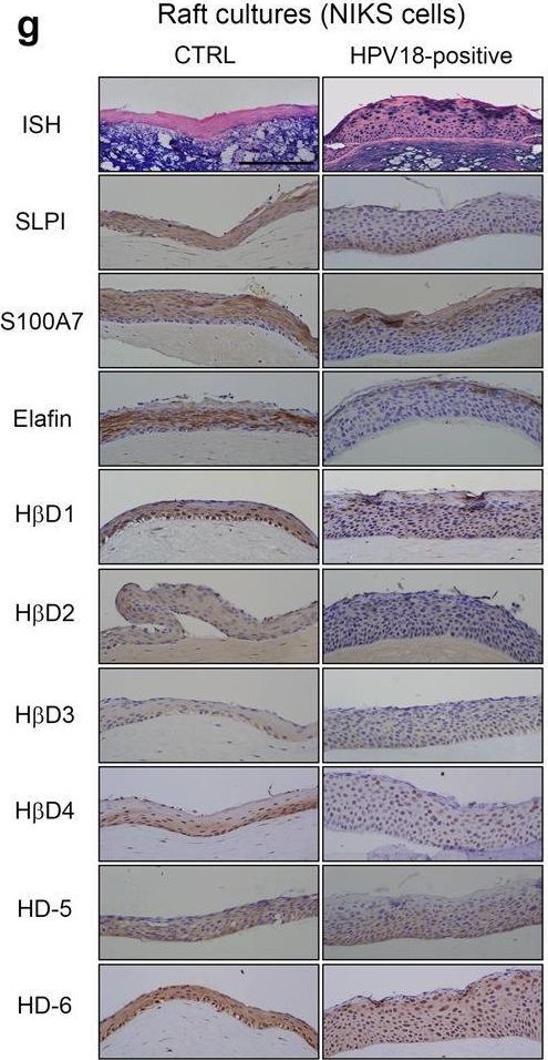 Fig.2.G showing Immunohistochemistry in a Homo sapiens (Human) sample from the publication: HPV infection alters vaginal microbiome through down-regulating host mucosal innate peptides used by Lactobacilli as amino acid sources.